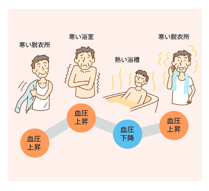 急激な温度の変化がヒートショックの引き金に
